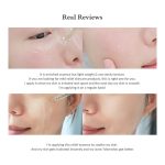 Dr.Althea Skin Relief Essence - Image 7