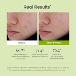 Purito Seoul Clear Code Superfruit Serum - Image 6