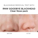 RNW 2 STEP Clear Nose Pack - Image 6