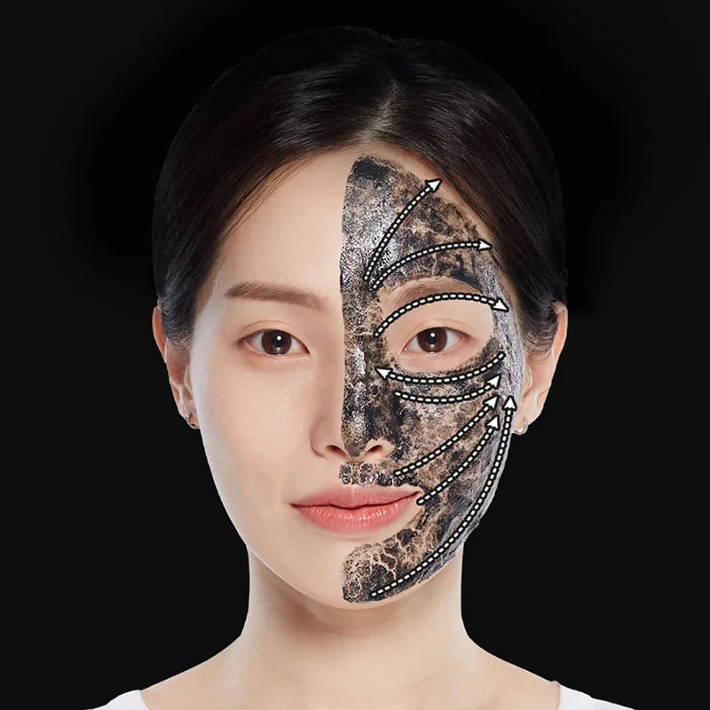 SKIN1004 Mummy Pack - Image 4